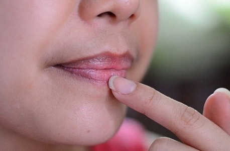 Penyebab Dan Cara Mengatasi Bibir Yang Hitam